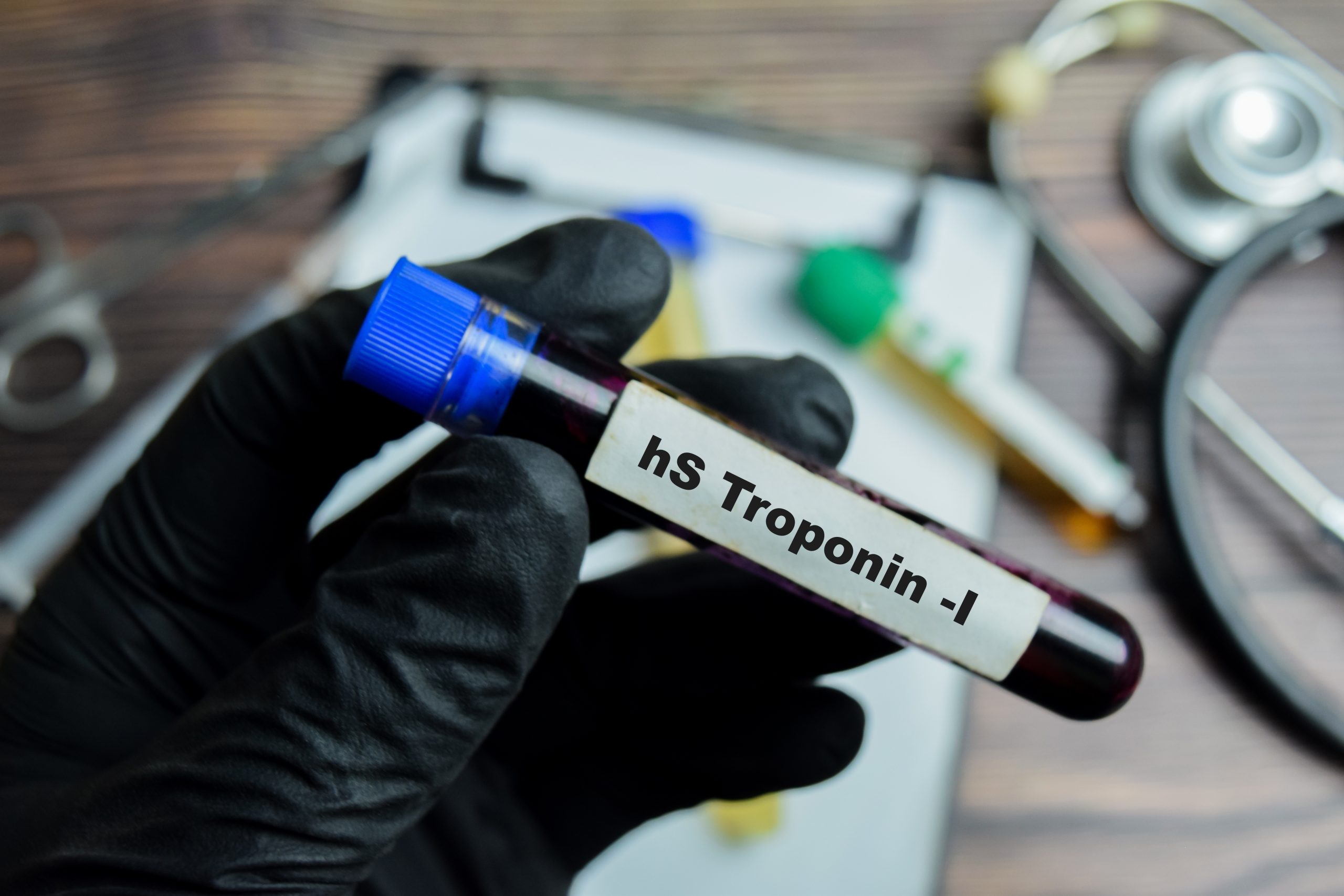 High-Sensitivity Troponin I (hs-Troponin I) blood test used to assess heart muscle injury and support heart attack diagnosis