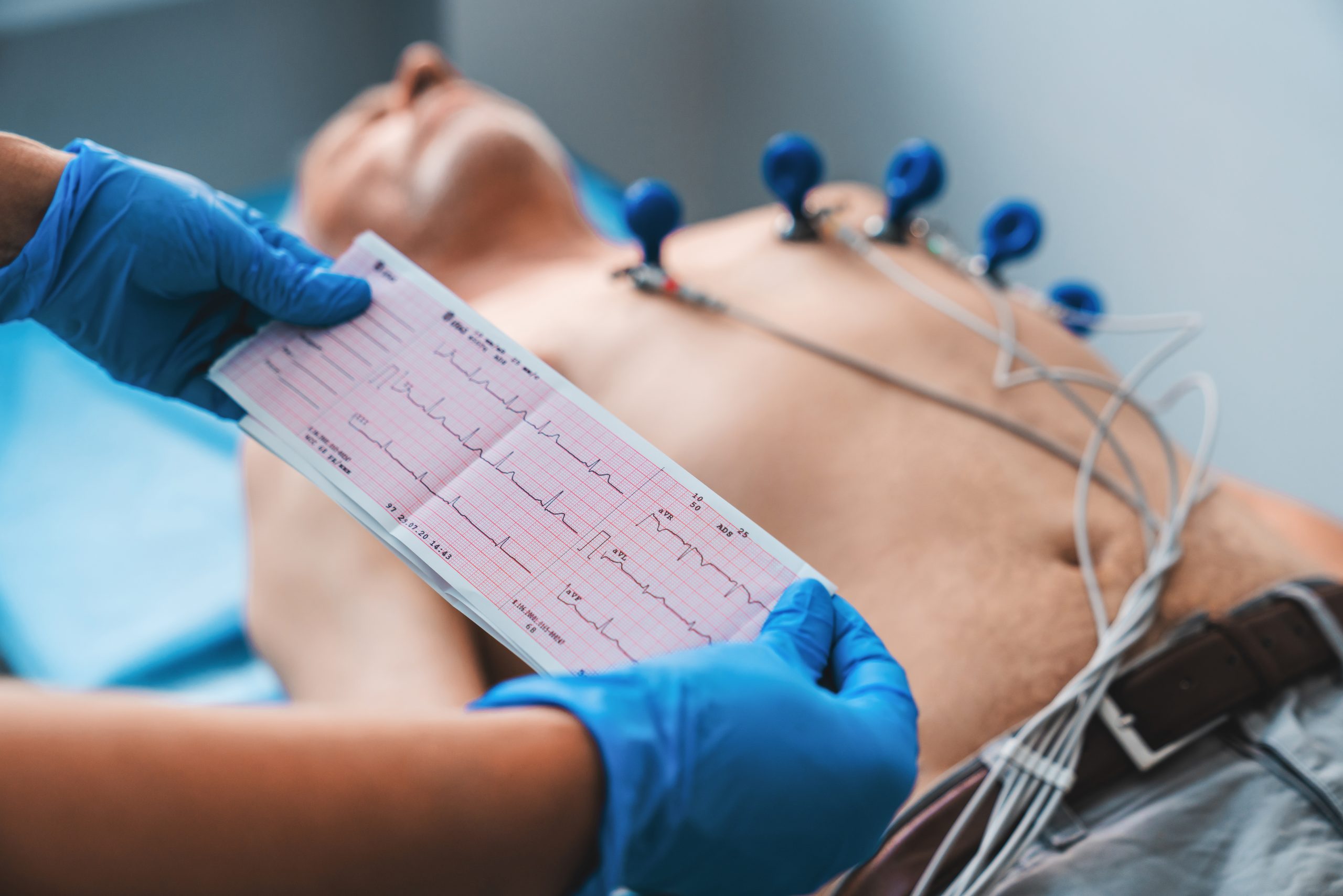 Resting ECG (Electrocardiogram) performed to assess heart rhythm and electrical activity