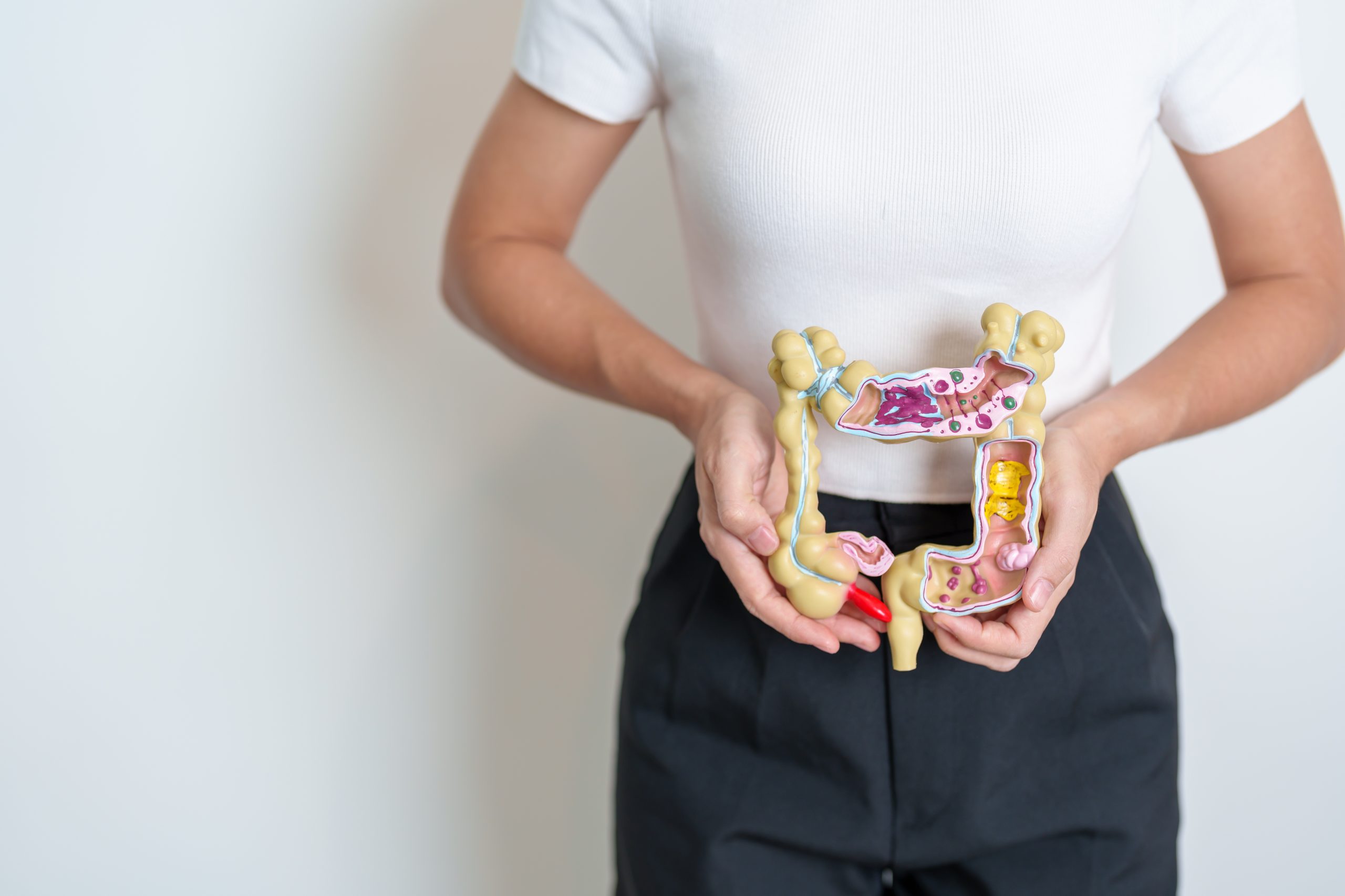 Colon model illustrating the importance of the Faecal Occult Blood Test (FOBT) for colorectal cancer screening