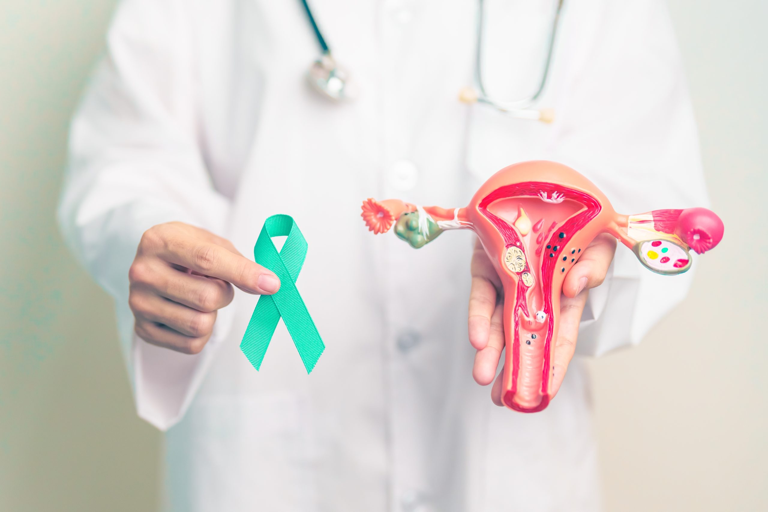 Medical illustration related to Ovarian Cancer Marker (CA 125), supporting patient education and health screening.