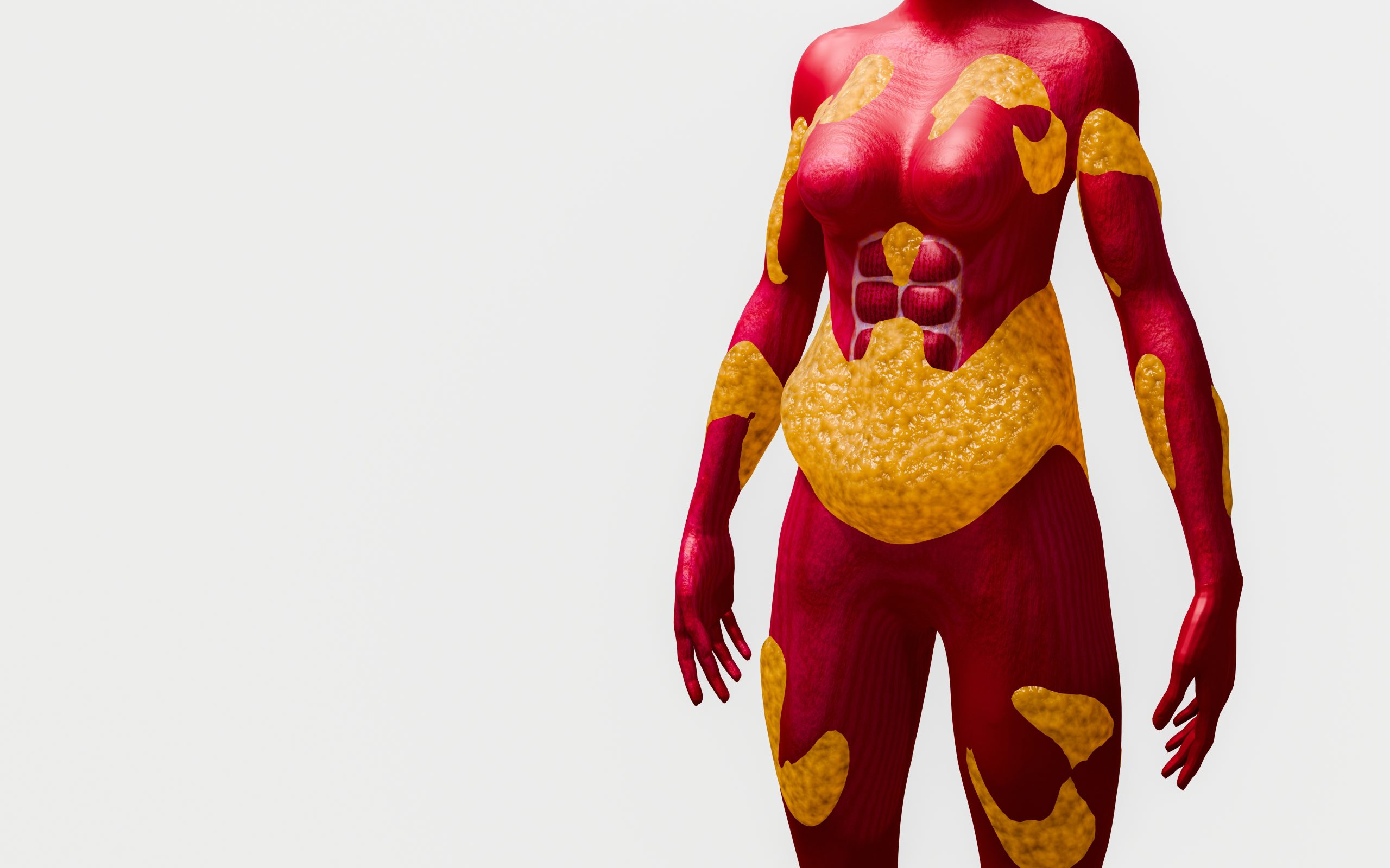 Medical illustration related to Visceral Fat, supporting patient education and health screening.